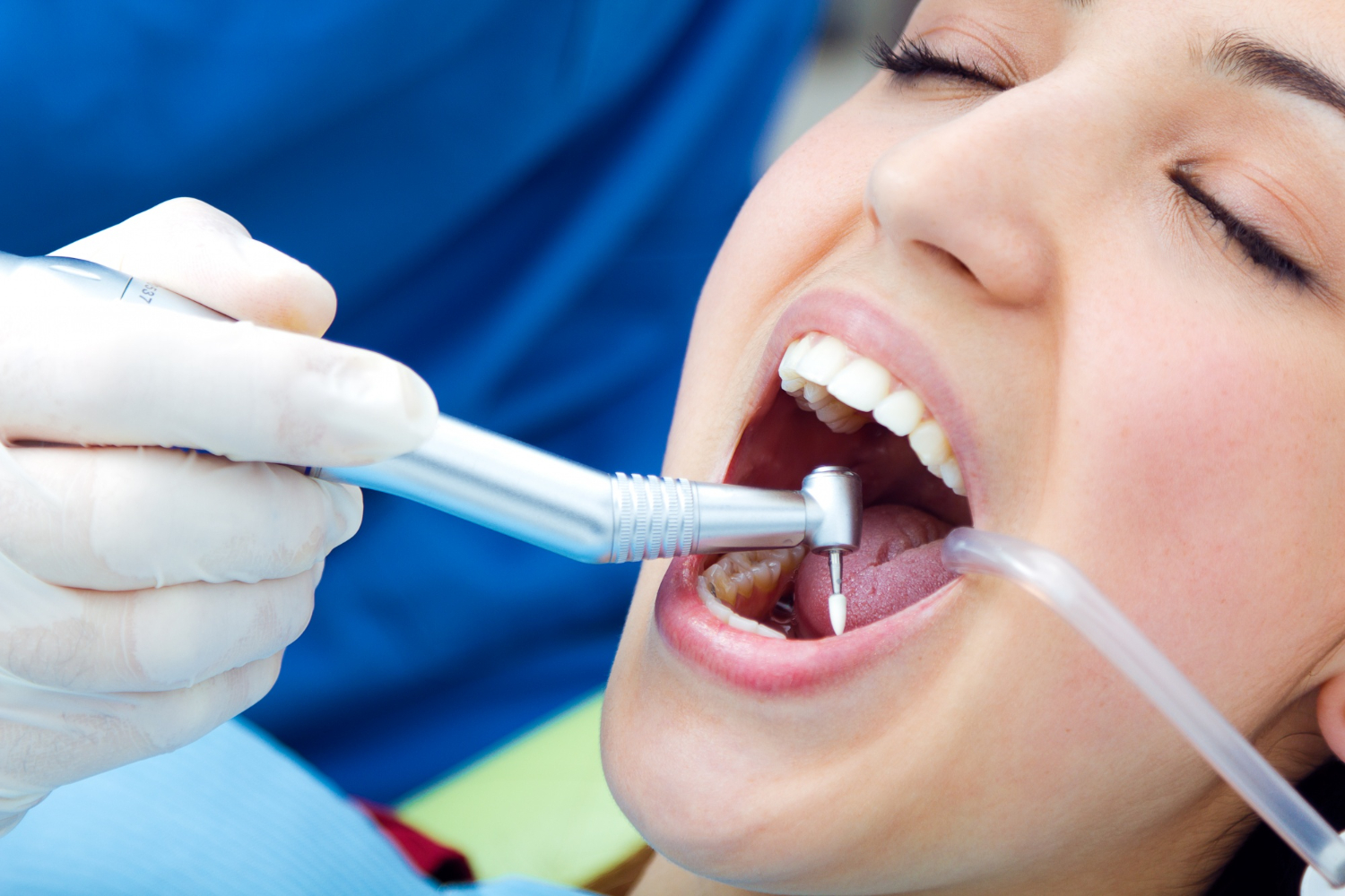 Root Canal Treatment in Mission Viejo